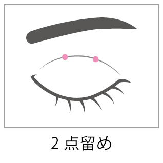 埋没法2点留め