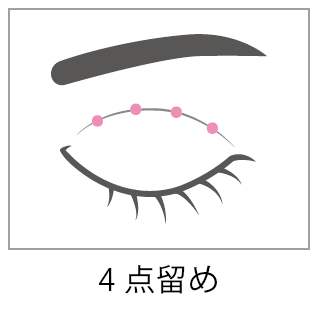 埋没法4点留め